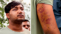 Source-feed image associated with India's 'cockroach' protesters have wounds consistent with pellet-gun fire, say experts