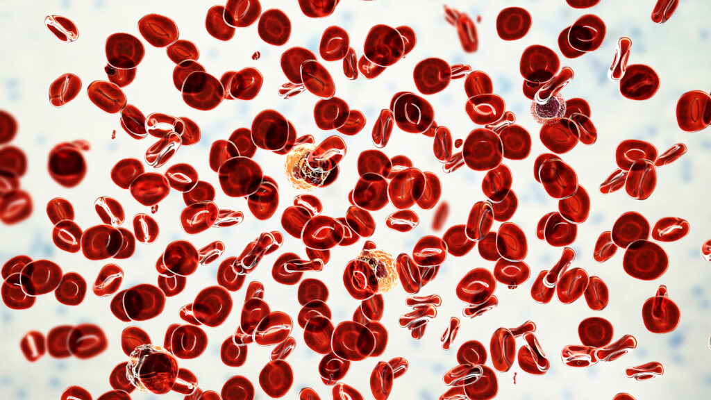 Source-feed image associated with STAT+: Silence Therapeutics aims at Takeda with new data in rare blood cancer