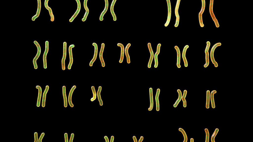 Source-feed image associated with STAT+: RA Capital backs upstart rival to Ultragenyx and Ionis in rare brain disease