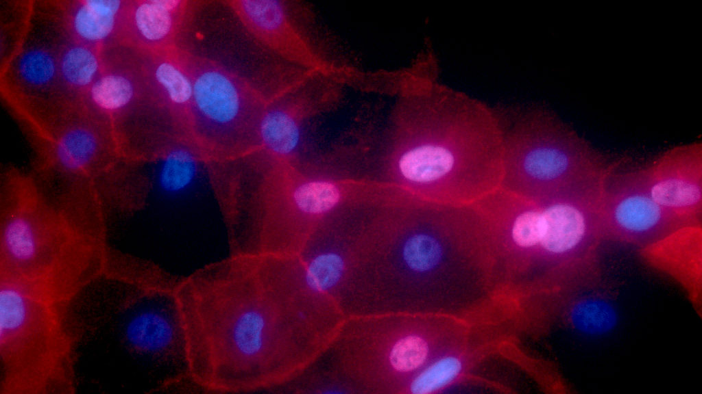 Source-feed image associated with STAT+: Celcuity’s breast cancer drug approved, its first