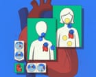 Source-feed image associated with I work in a hospital – and didn’t know I was having a heart attack. Here’s what more women should know