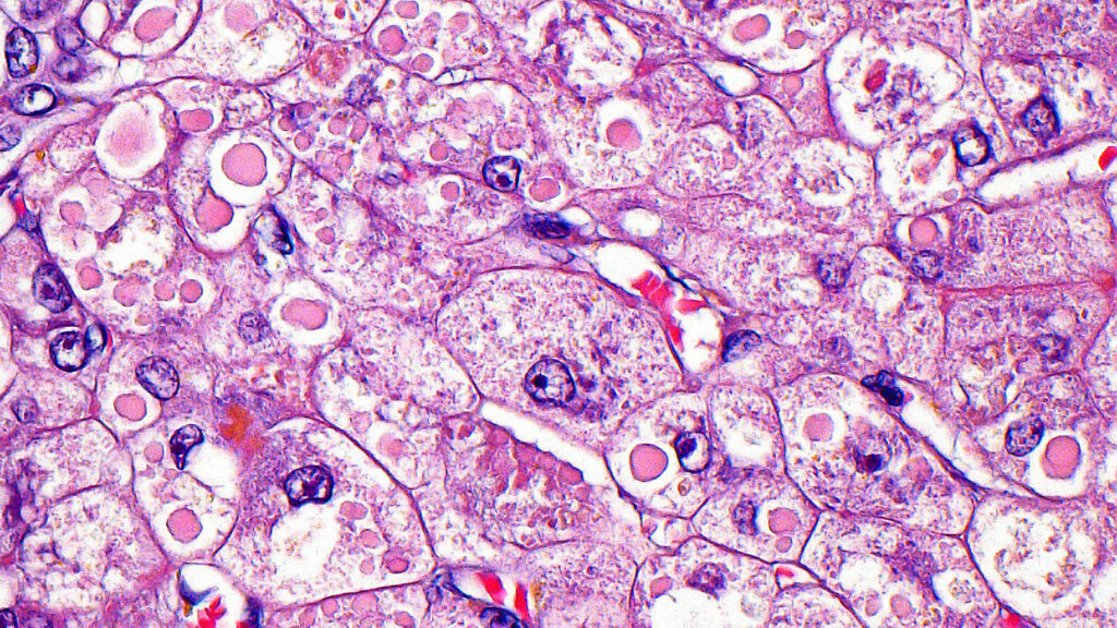 Source-feed image associated with STAT+: Gene-editing startup launches with $230 million and a Chinese licensing deal