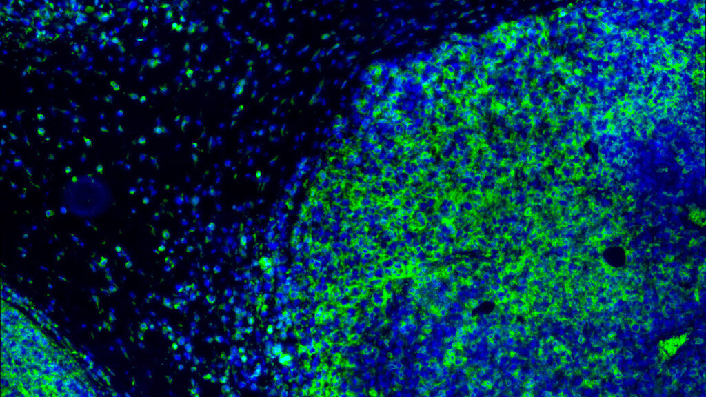 Source-feed image associated with STAT+: Inhibrx claims first win for long-sought immunotherapy target