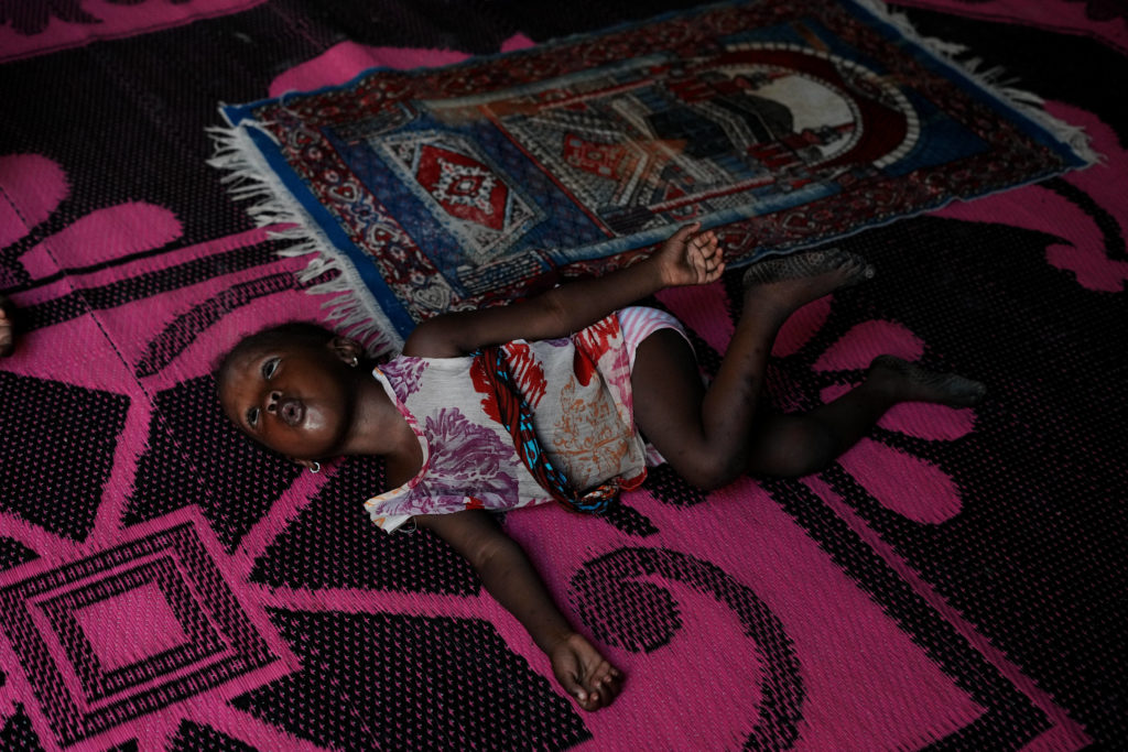 Source-feed image associated with Nigerian children pay the price for the Iran war as malnutrition and poverty surge