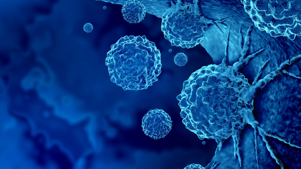 Source-feed image associated with STAT+: Are cancer patients getting too much drug?