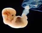 Source-feed image associated with The Guardian view on gene-edited humans: darker uses must be acknowledged alongside medical ones | Editorial