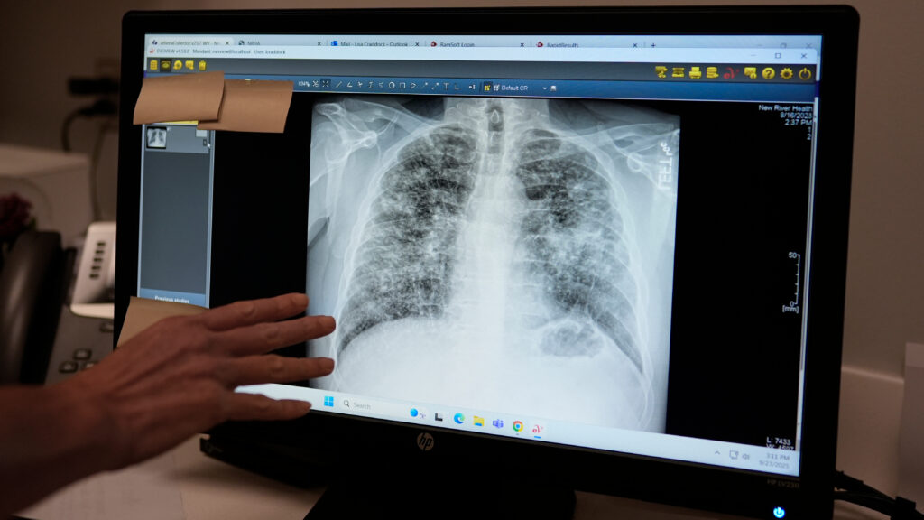 Source-feed image associated with STAT+: FDA gives generative AI in radiology two breakthrough designation nods