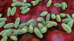 Image from linked report: What is pneumonic plague and how does it spread?