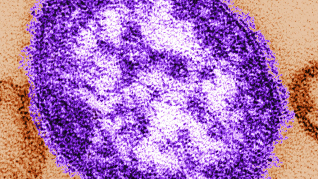 Source-feed image associated with Pennsylvania officials report state’s third death involving measles