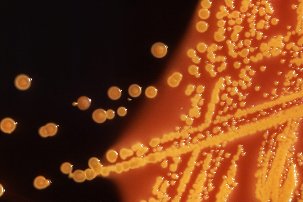 Source-feed image associated with What happened in 5 previous outbreaks of foodborne illnesses at restaurant chains