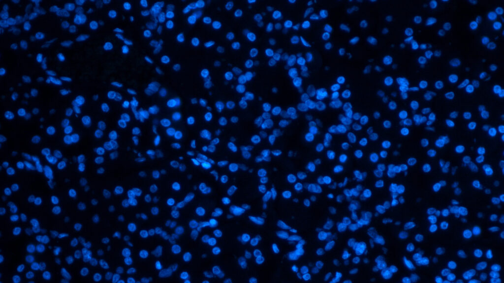 Source-feed image associated with STAT+: Ahead of ASCO, all eyes on pancreatic cancer