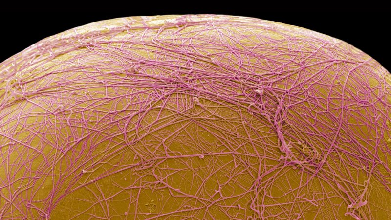 Image from linked report: An experimental drug kills fat cells, rather than shrinking them