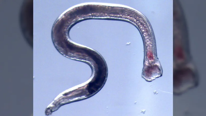 Source-feed image associated with Engineered hookworms could one day dispense drugs from inside your gut