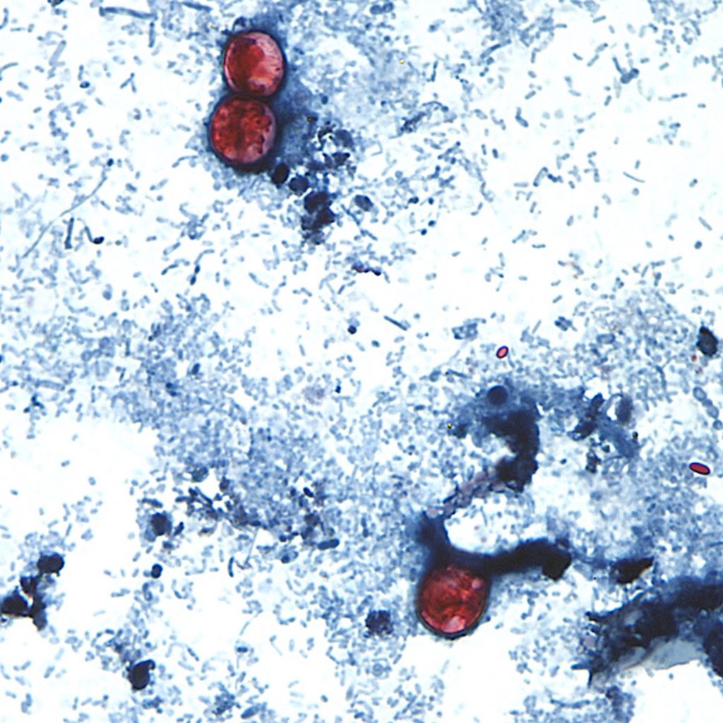 Source-feed image associated with Test results create more confusion around cyclosporiasis outbreak