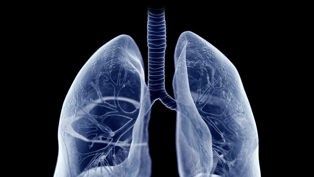 Source-feed image associated with STAT+: Roivant lung disease drug hits mid-stage study goals