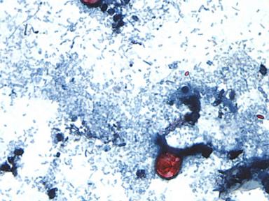 Source-feed image associated with Taylor Farms recalls lettuce shipped to 27 states over cyclospora risk