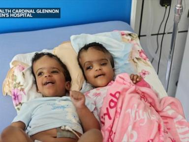 Source-feed image associated with WATCH: Conjoined twins begin new chapter after successful separation