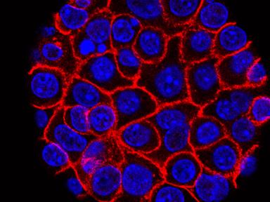 Source-feed image associated with Experimental pill promises new hope for deadly pancreatic cancer