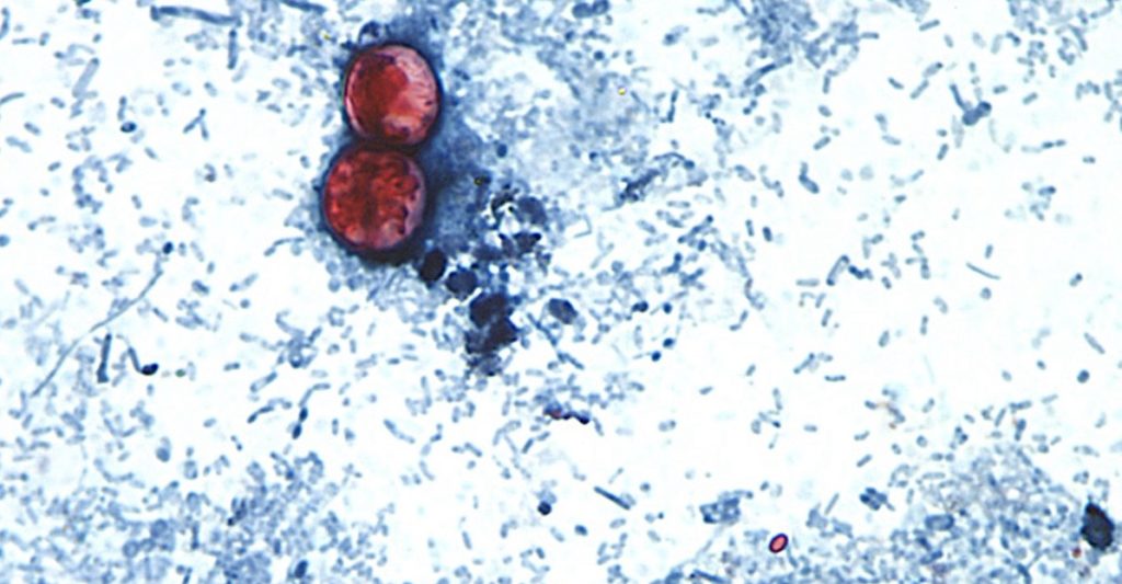 Source-feed image associated with Taylor Farms recalls lettuce shipped to 27 states over cyclospora risk