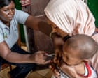 Source-feed image associated with Children make up half of mpox cases in Guinea-Bissau as epidemic spreads