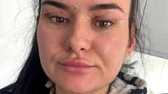 Image from linked report: Open wounds and eyes that can't close - women warn about cheap bleph eyelid surgery