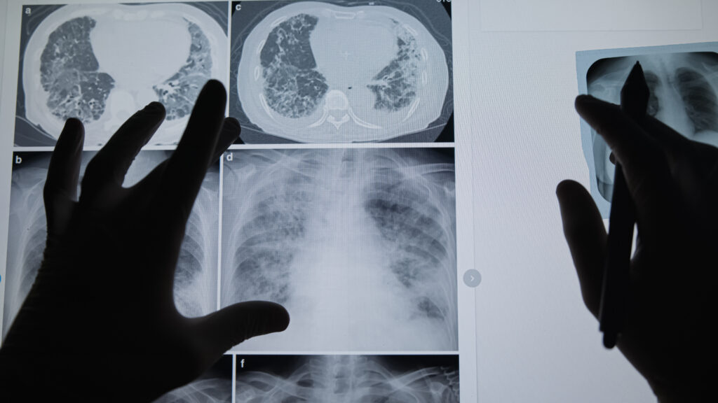 Source-feed image associated with Opinion: How my cancer diagnosis changed the way I train physicians