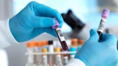 Source-feed image associated with Two possible Ebola cases in Brazil ruled out as patients test negative