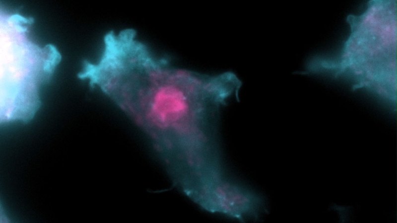Image from linked report: Here’s how brain-eating amoebas may infect people