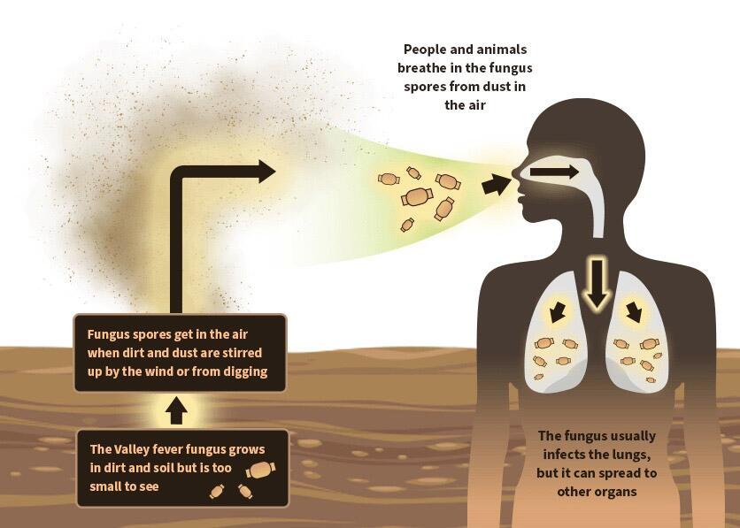 Source-feed image associated with New drug could help people stricken with valley fever