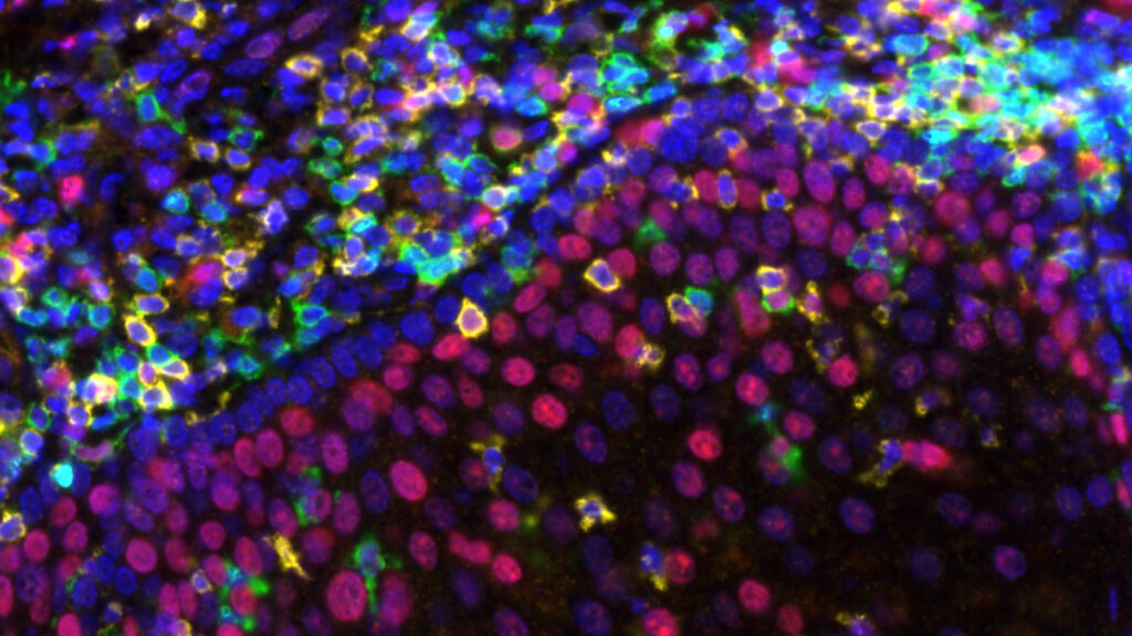 Source-feed image associated with Ultra-low doses could bring costly cancer treatments to more patients in poorer countries