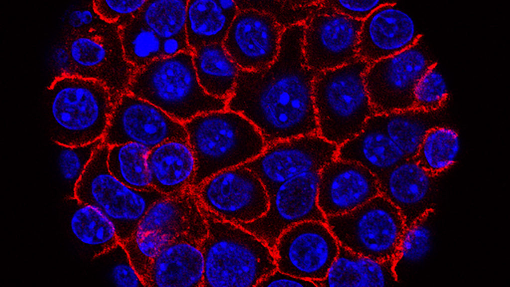 Source-feed image associated with STAT+: Combination of pancreatic cancer drugs from Tango, Revolution leads to high response rate