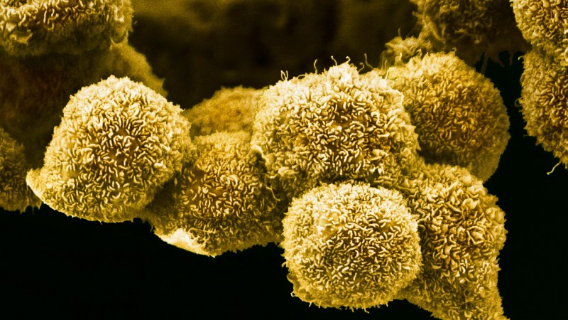 Source-feed image associated with A new pancreatic cancer pill may be a game changer for patients