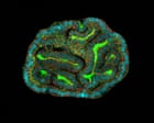 Source-feed image associated with ‘A mouse can’t tell us what works’: UK scientists to grow miniature human organs for drug testing