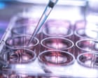 Source-feed image associated with UK’s stem cell transplant system may be putting lives at risk, report by MPs finds