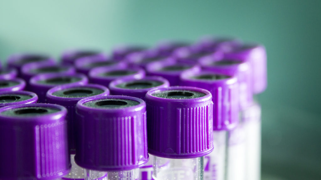 Source-feed image associated with Opinion: Beware the unintended consequences of testosterone screening for military servicemembers