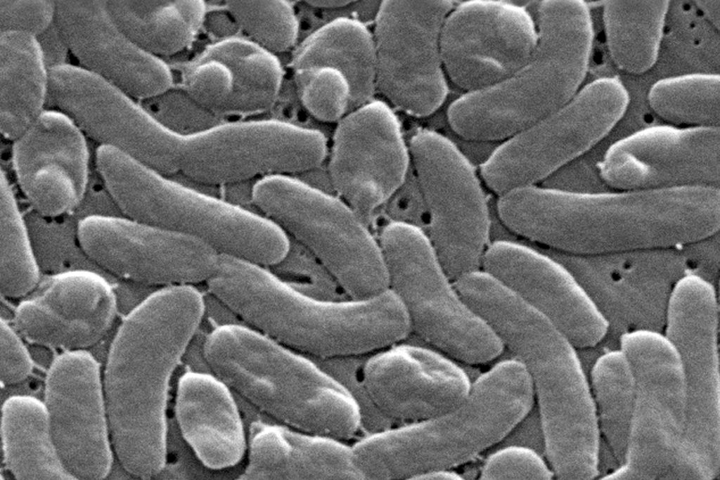 Source-feed image associated with Health officials urge caution for Gulf Coast beachgoers during surge of deadly bacterial infections