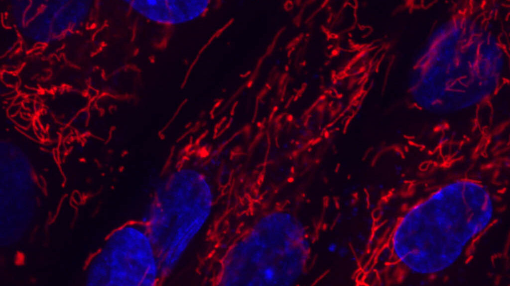 Image from linked report: STAT+: Kyverna’s cell therapy shows lasting autoimmune benefit