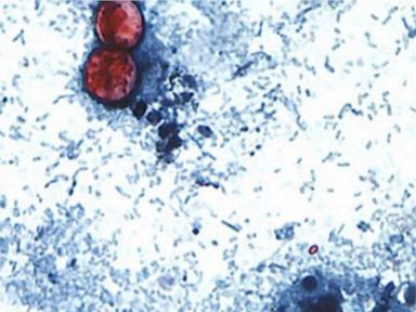 Source-feed image associated with Taco Bell voluntarily removes some ingredients at restaurants amid parasitic outbreak