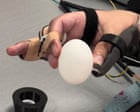 Source-feed image associated with Brain implant helps paralysed man to feed himself and drink from cup
