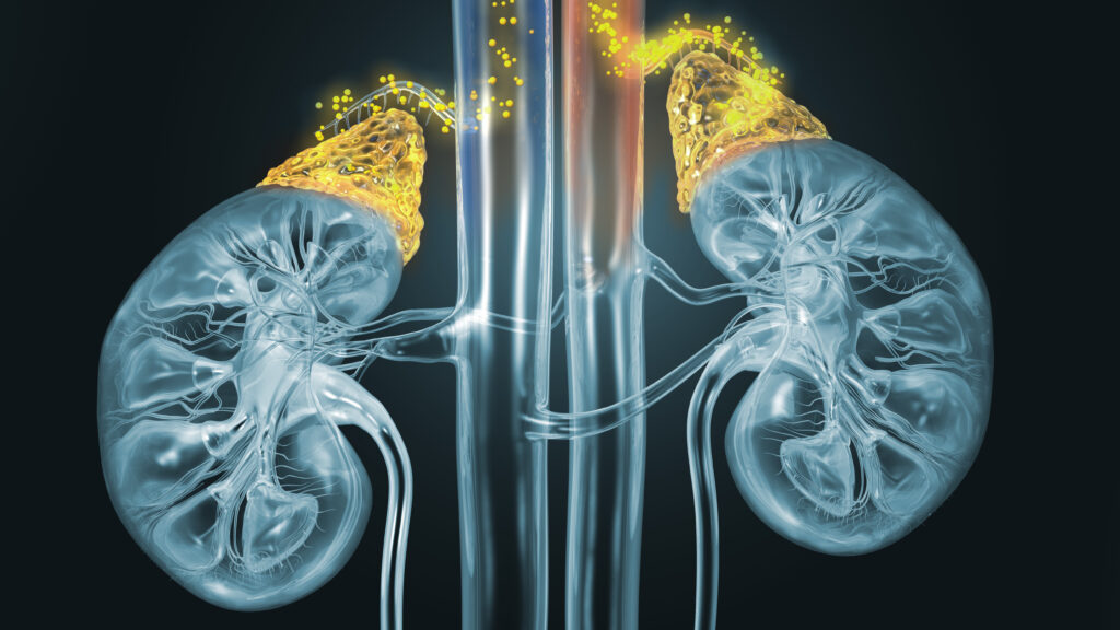 Source-feed image associated with STAT+: Despite transplant referrals, most kidney patients don’t make the waitlist