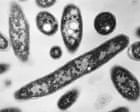 Source-feed image associated with Legionnaires’ outbreak rocks New York as experts warn of rising climate threat