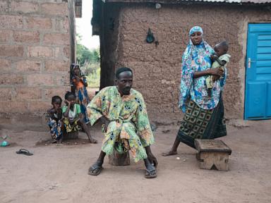 Source-feed image associated with In Benin, malnutrition and misinformed views contribute to widespread stunting in children