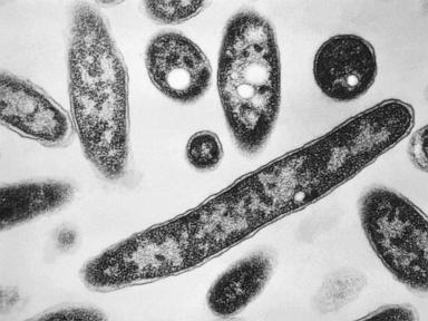 Source-feed image associated with Second death reported in Legionnaires’ disease outbreak in New York City