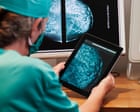 Source-feed image associated with AI will help find cure for cancer ‘within our lifetimes’, says Arm Holdings chief