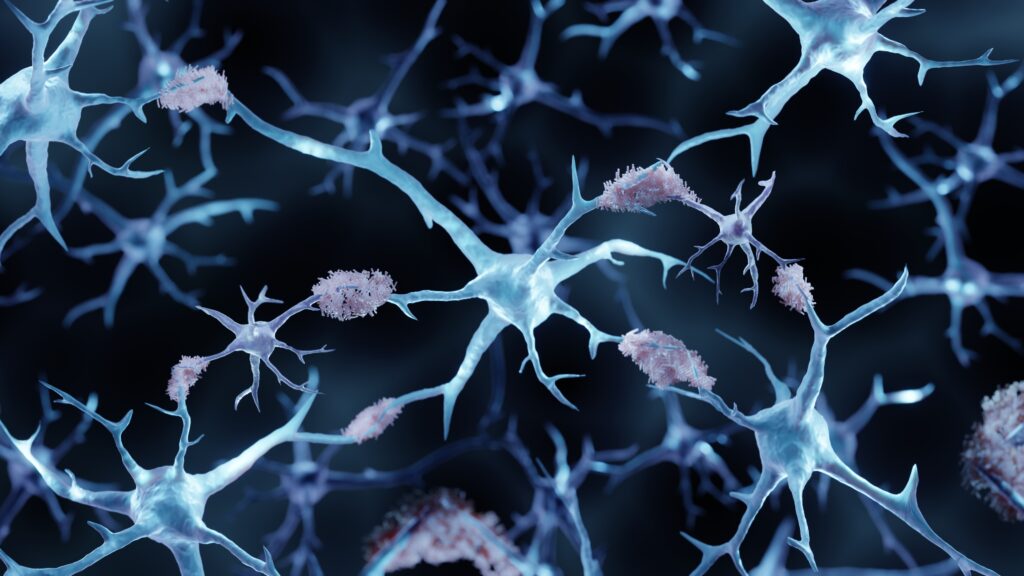 Source-feed image associated with STAT+: Preliminary trial results suggest a path to a safer Alzheimer’s treatment