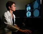 Source-feed image associated with Groundbreaking genomic test could spare millions of breast cancer patients chemotherapy