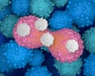 Source-feed image associated with Smart drug that strips cancer cells of ‘invisibility cloak’ can shrink tumours by 30%, trial shows