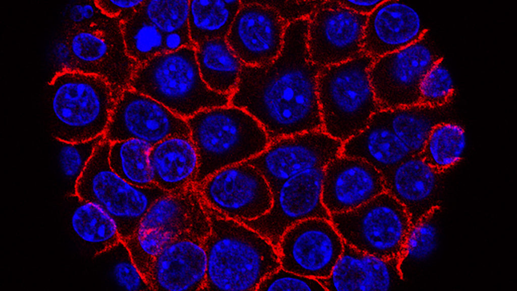 Source-feed image associated with STAT+: ‘Synthetic lethality’ could trigger another round of biotech M&A