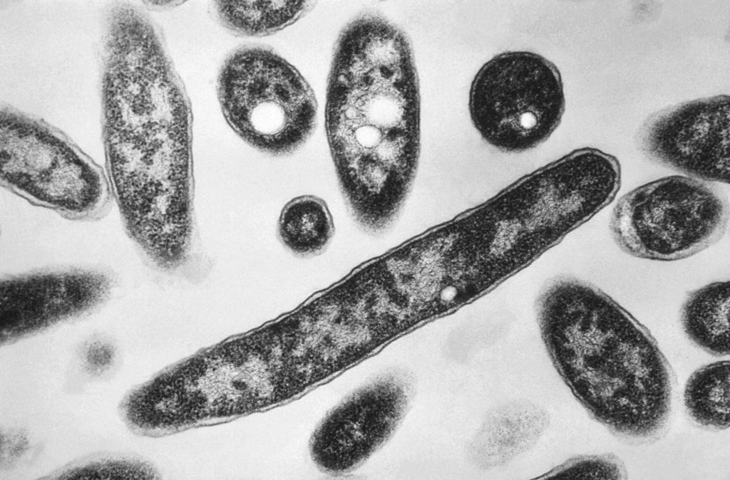 Source-feed image associated with First death reported in Legionnaires' disease outbreak in New York City